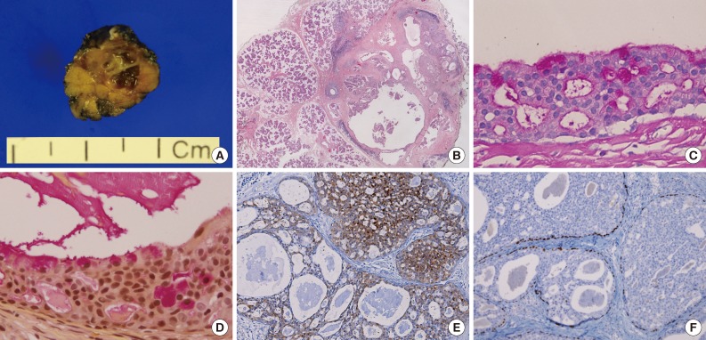 kjpathol-47-592-g002.jpg