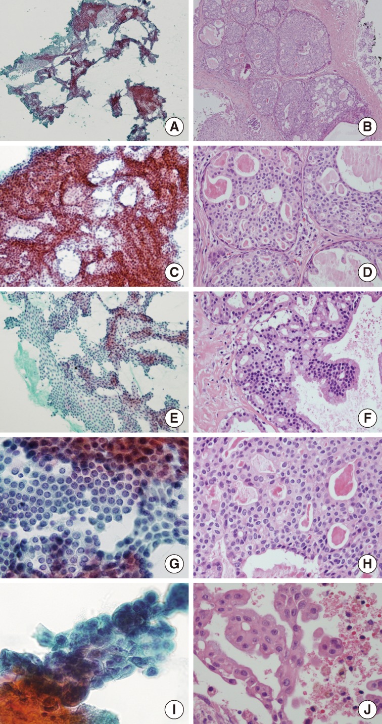 kjpathol-47-592-g003.jpg