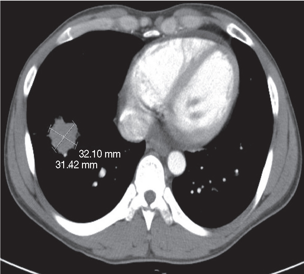 kjpathol-48-5-387f1.jpg